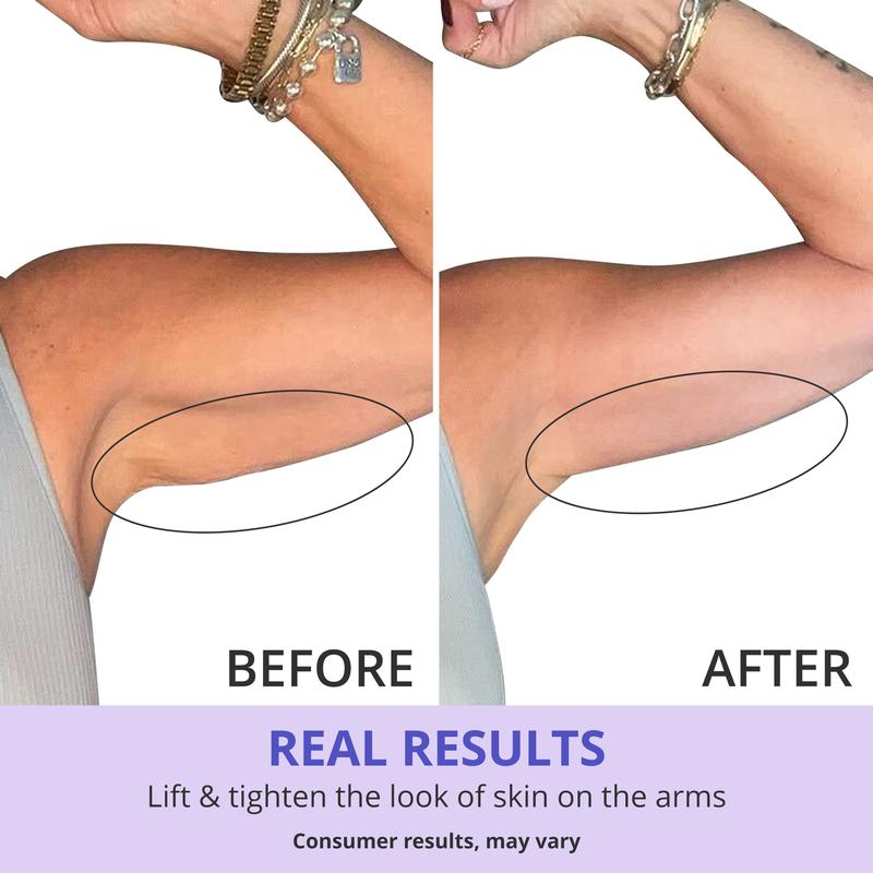 Solstice™ Sculpt & Tone Arm Cream - Solstice