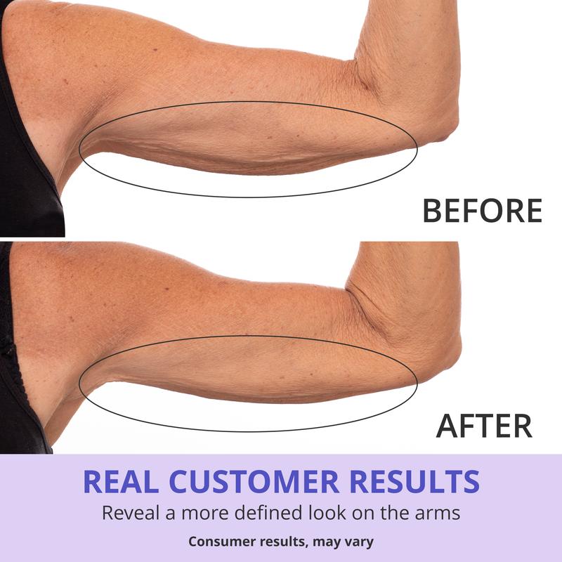 Solstice™ Sculpt & Tone Arm Cream - Solstice